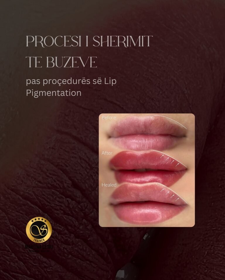 Lip Pigmentation